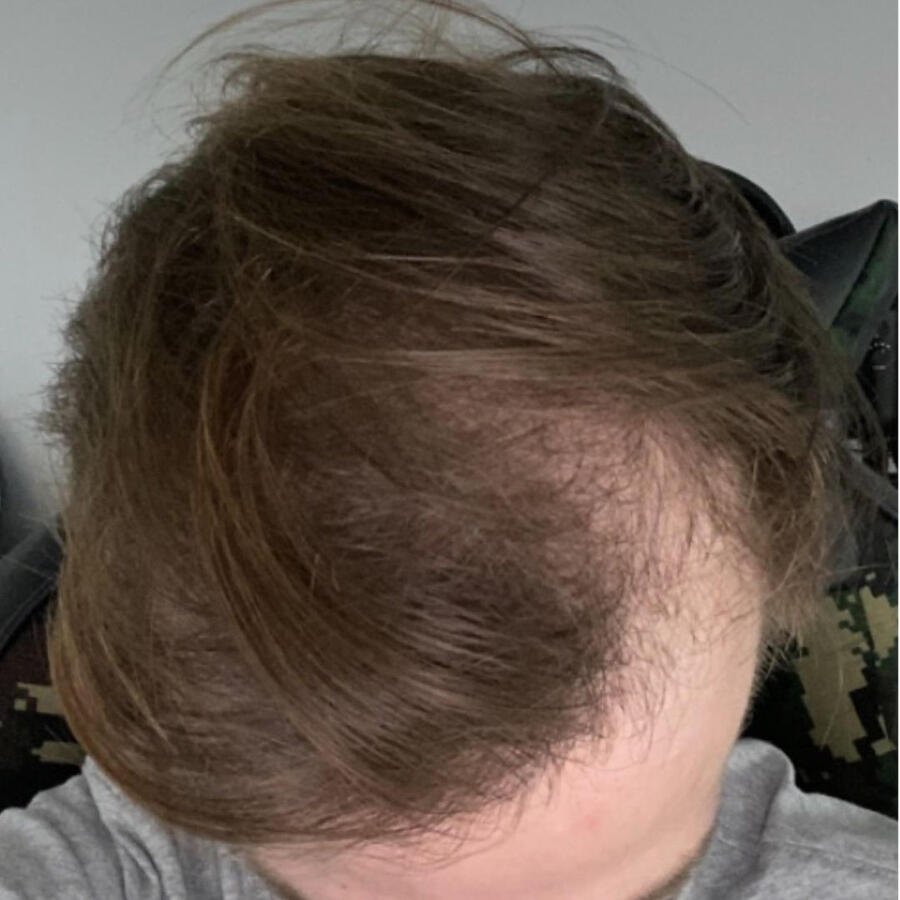 BEFORE